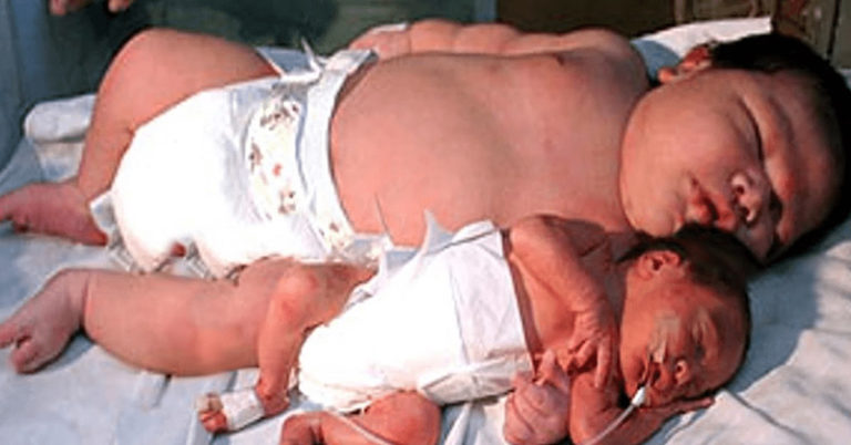 The Biggest Babies Ever Born - Featured image