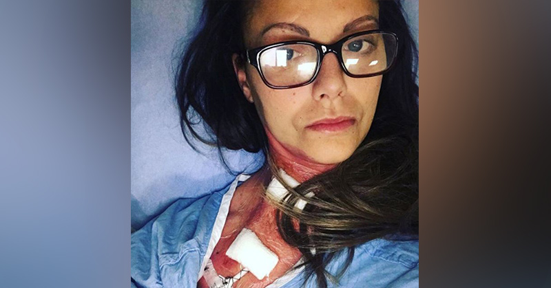 I Almost Died From Toxic Shock Syndrome and It Had Nothing to Do With a Tampon - Featured image