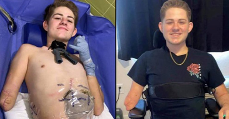 Teenager Crushed By Forklift Chose To Amputate Bottom Half Of Body To Save His Life - Featured image
