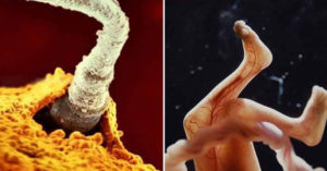 These Photos Perfectly Capture The Stages of Baby Development Before Birth baby development photos