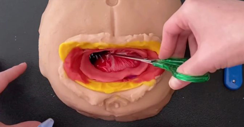 play doh c-section