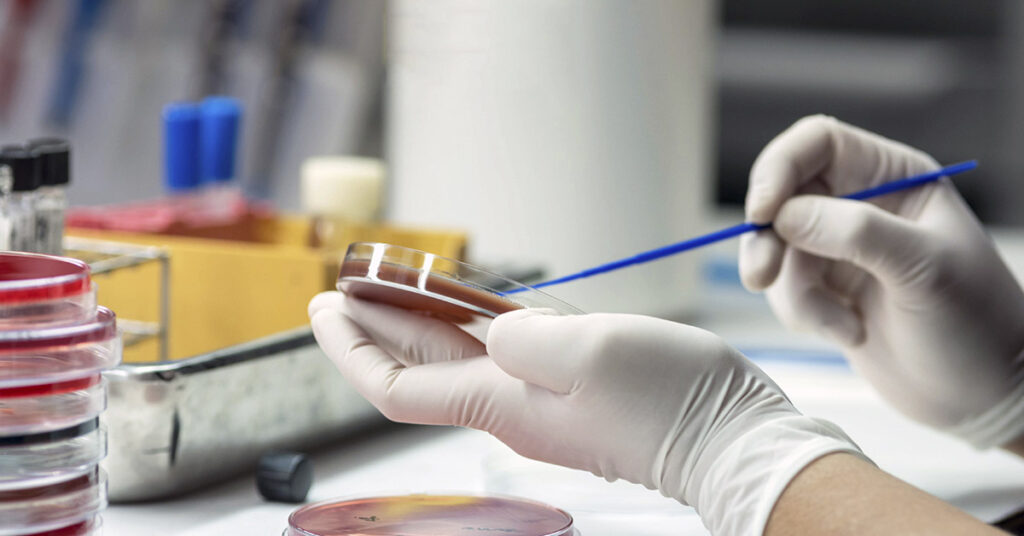 Doctors Still Struggle to Diagnose a Condition That Kills More Americans Than Stroke - Featured image