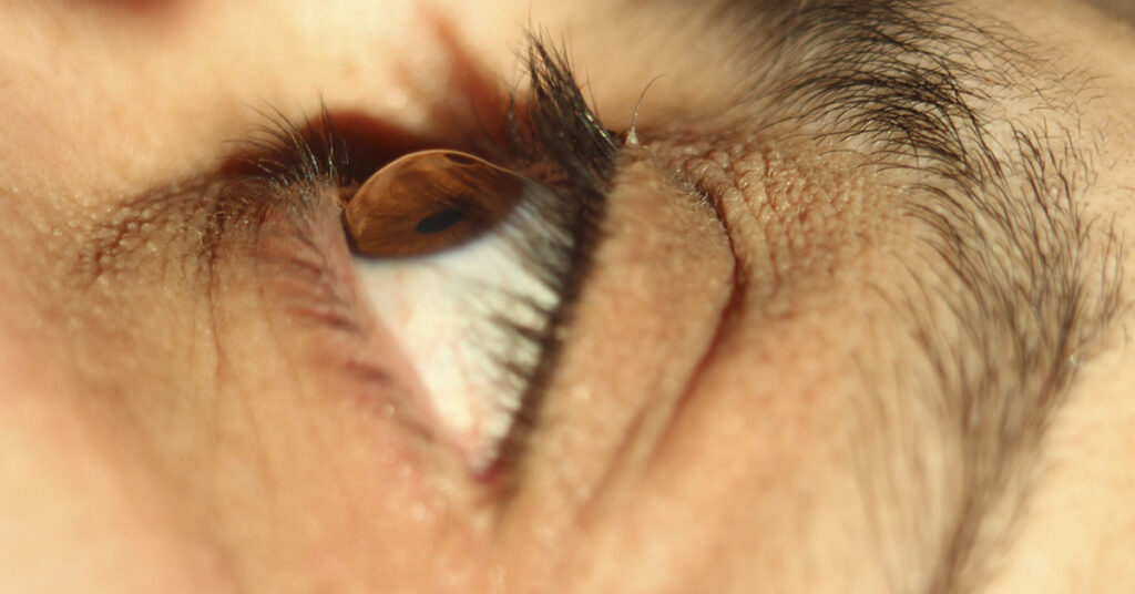 This is Why You Should Never Sleep With Contacts In - Featured image