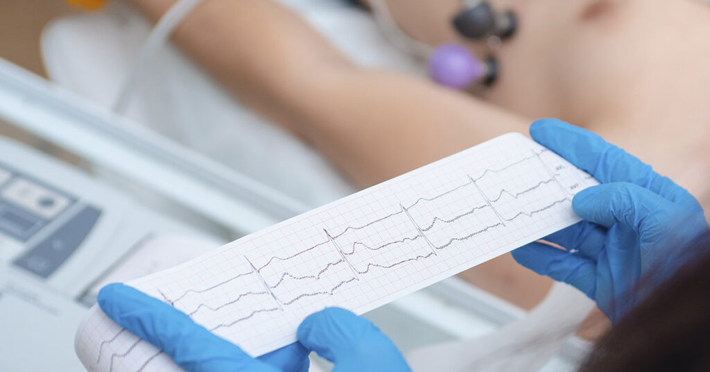 Heart Health: 6 Foods Cardiologists Try to Avoid - Featured image