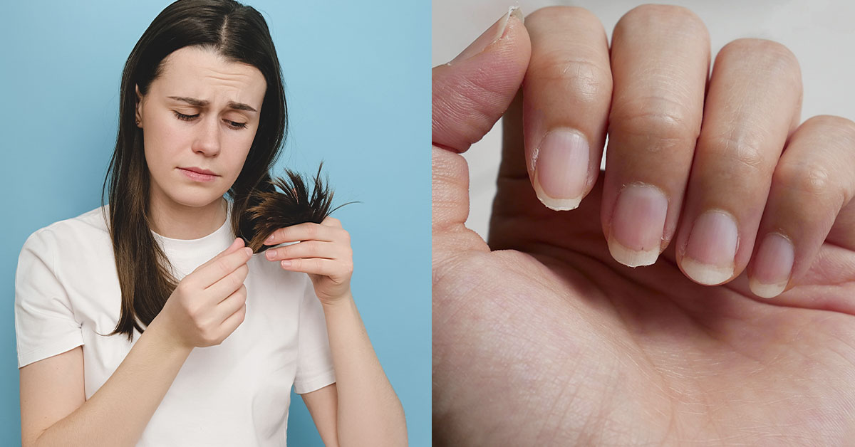 woman with brittle hair and nails