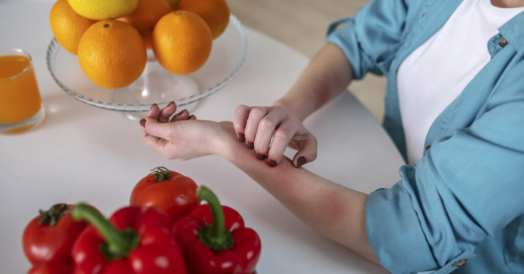 Why your grandparents had fewer food allergies, but you don’t - Featured image