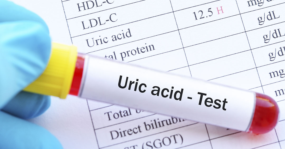Uric acid test