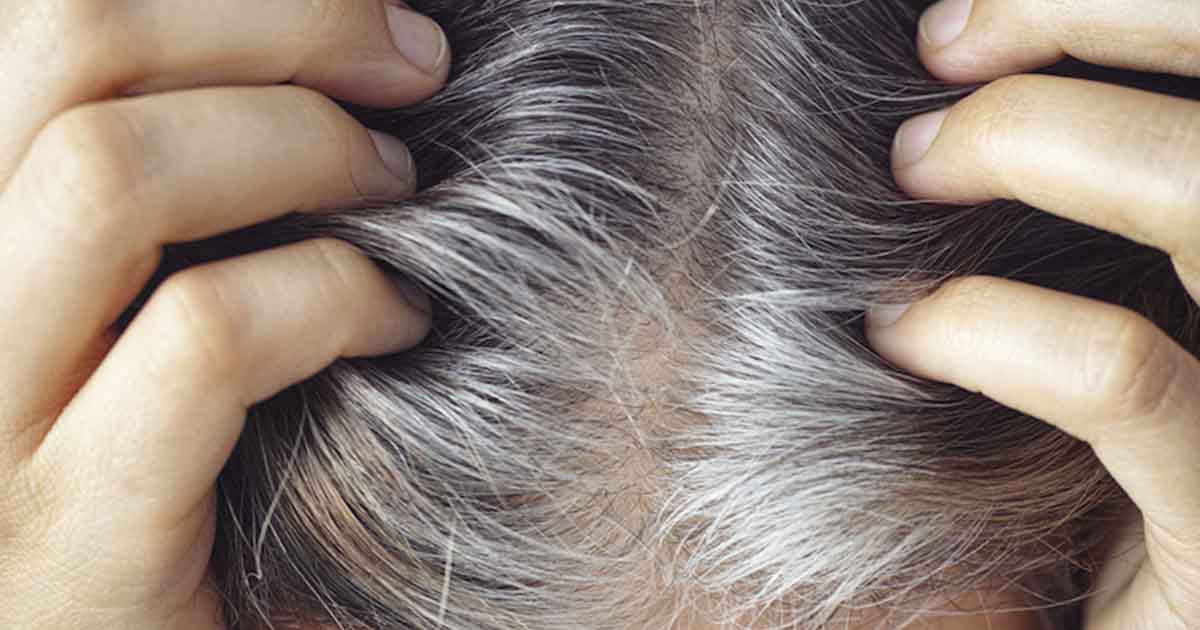 16 Signs of Copper Toxicity The Hearty Soul