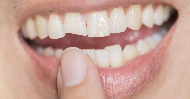 New Treatment Makes Teeth Grow Back - Featured image