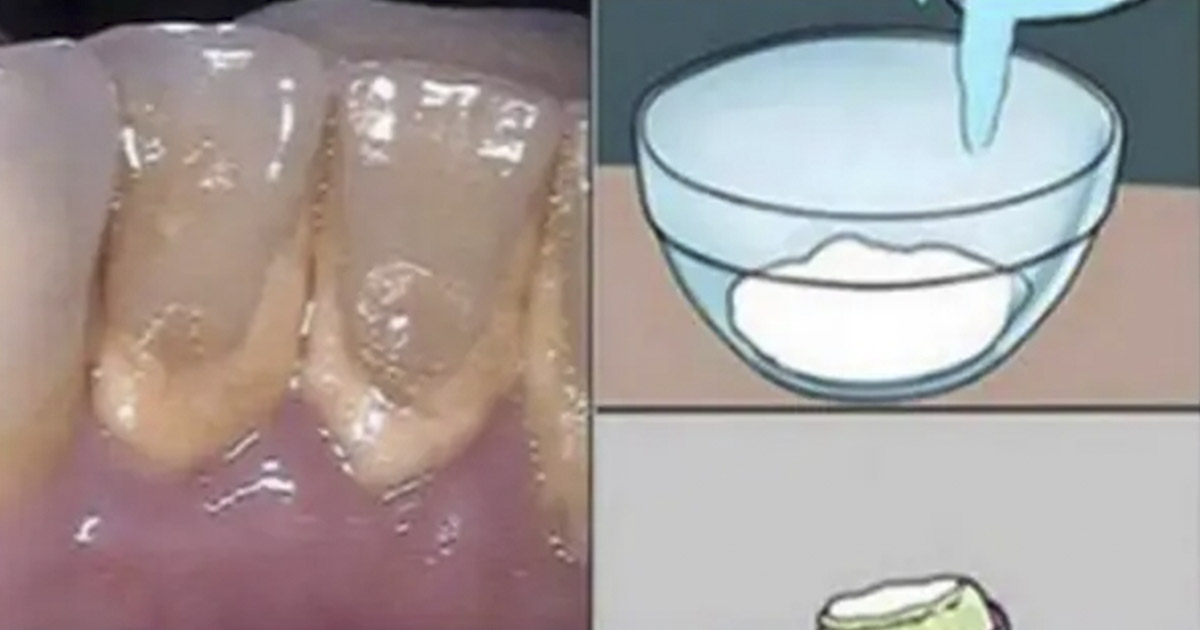 DIY Mouth Wash 3 Easy to Make Recipes The Hearty Soul