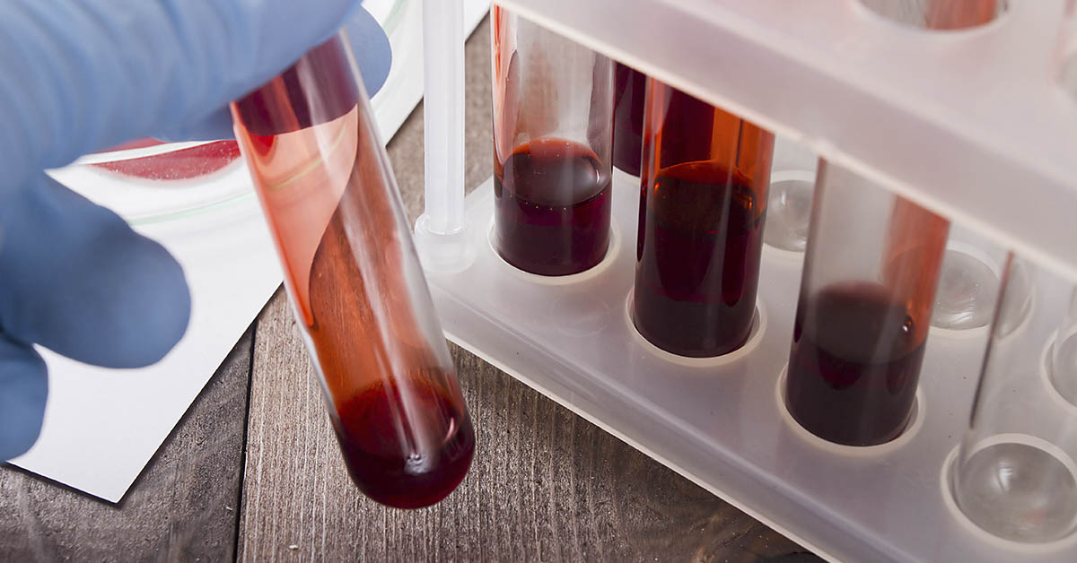 vials of blood to harvest stem cells