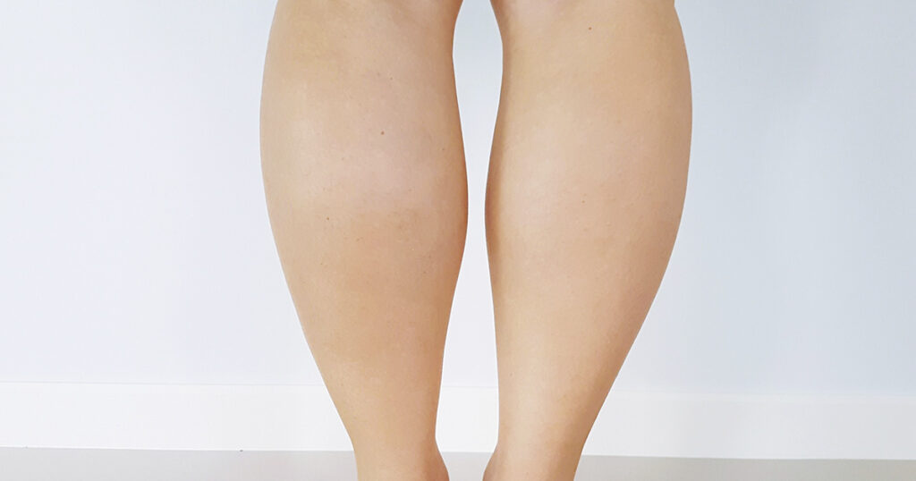 7 Things That Contribute To Fluid Retention The Hearty Soul 7-things-that-contribute-to-fluid-retention-the-hearty-soul