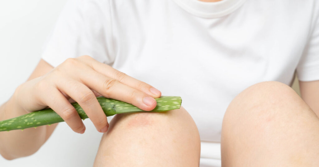 woman applying aloe vera to knee for inflamation