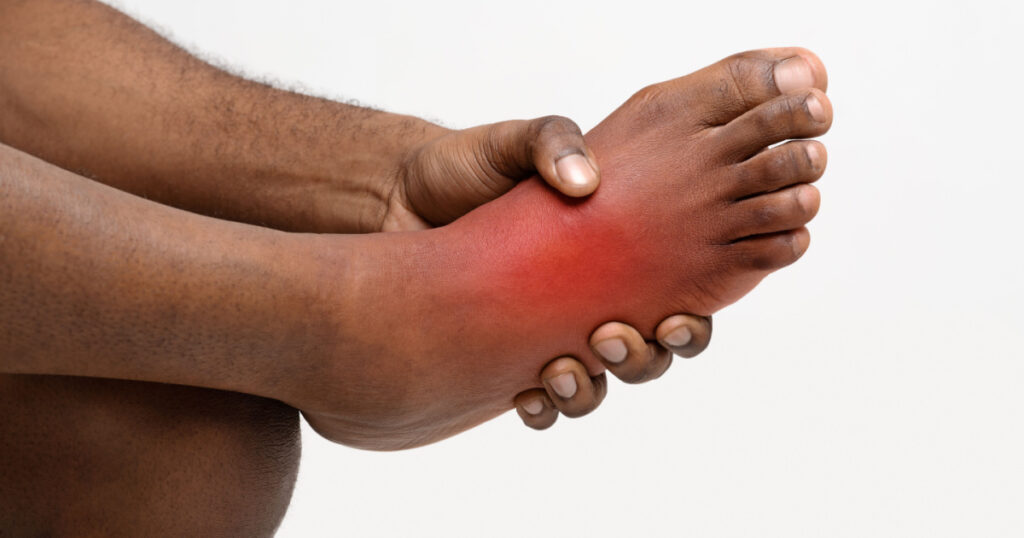 Cropped of black man holding his painful foot, cramp, muscular spasm, red accent on sore zone