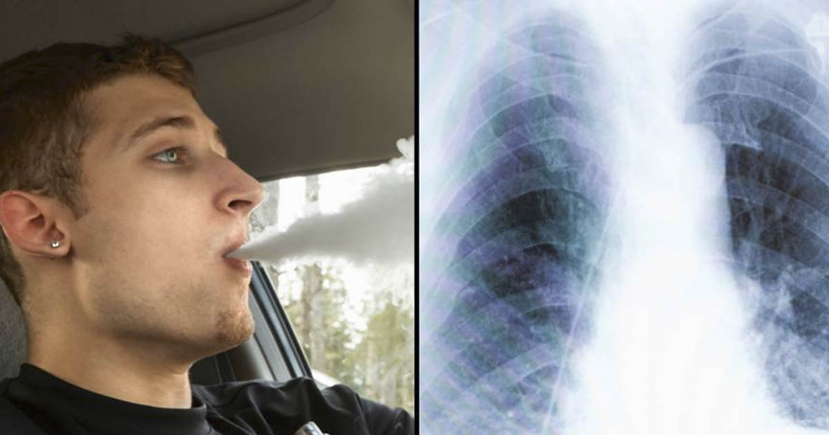 This is what happens to your body why you give up vaping The Hearty Soul