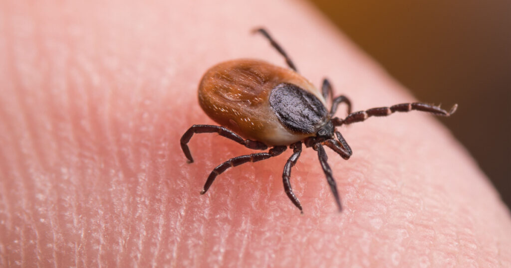 Female deer tick on skin of human finger. Ixodes ricinus or scapularis. Close-up of dangerous parasitic mite in dynamic motion on fingertip with friction ridges. Diseases transmission as encephalitis.
