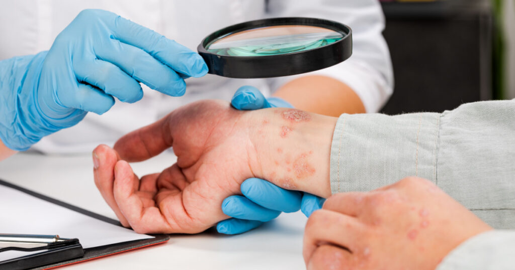 A dermatologist wearing gloves examines the skin of a sick patient. Examination and diagnosis of skin diseases-allergies, psoriasis, eczema, dermatitis.
