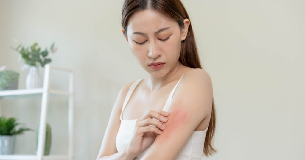 Skin manifestations like rashes, hives, or eczema-like patches can occur in chronic Lyme disease cases.