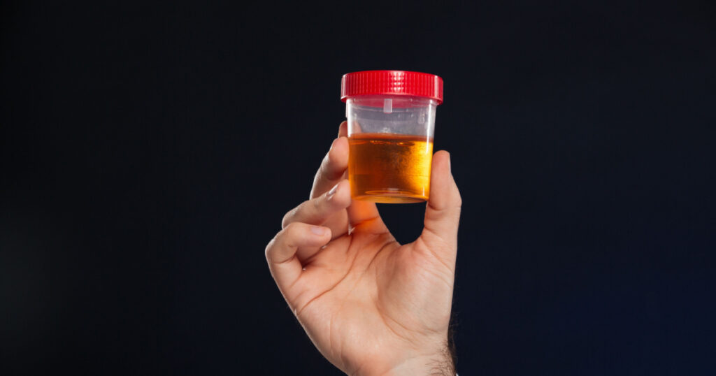 Close up of male's hand holding container with urine sample isolated over dark background
