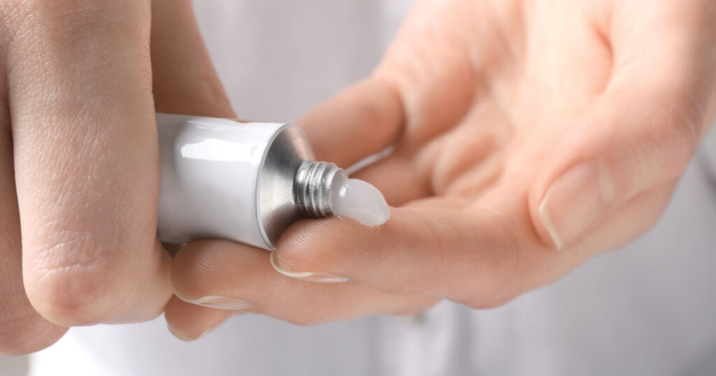 Woman squeezing out ointment from tube on her finger, closeup
