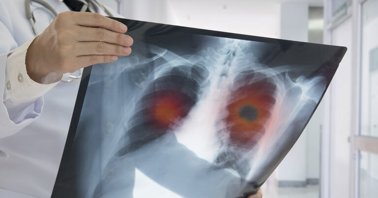 By Using Therapies New and Old, Woman Who Was Told She Had Months to Live, Battles On Six Years Later - Featured image