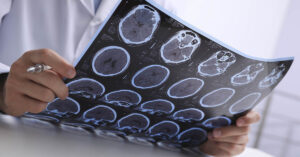 25 Things Only Someone with MS Would Know person looking at brain scans