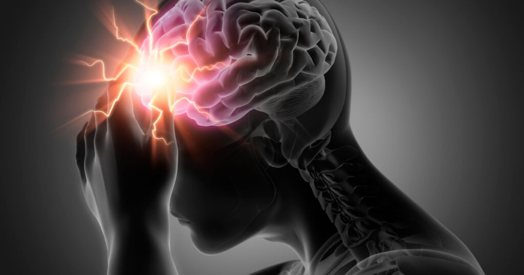 3 Vitamin Deficiencies Linked to Headaches - Featured image