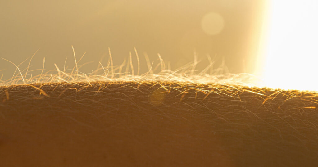 LENS FLARE, MACRO: Human hand with upright body hairs glowing in golden sunlight. Detailed view of a hairy arm with goosebumps. Young person reacts to the cold from a chilly breeze blowing at sunset.