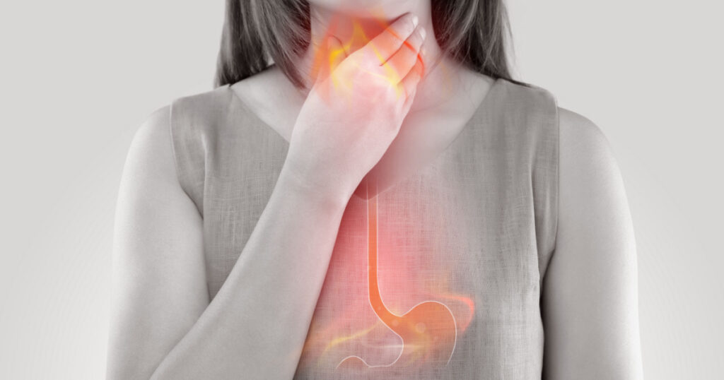 Woman Suffering From Acid Reflux Or Heartburn-Isolated On White Background
