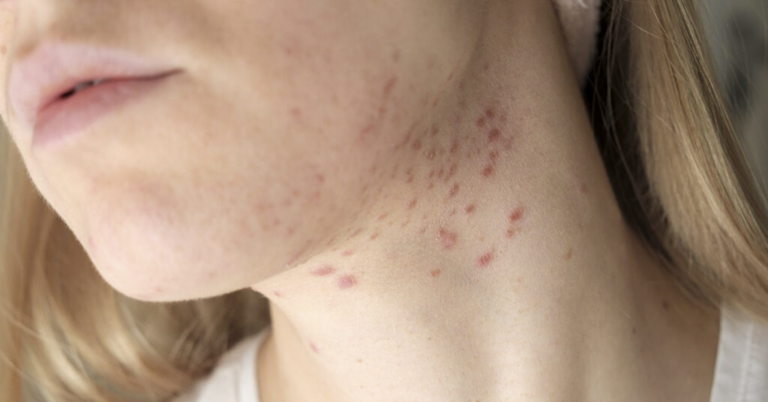 20 Signs Your Body is Out of Balance, and Something is Wrong - Featured image