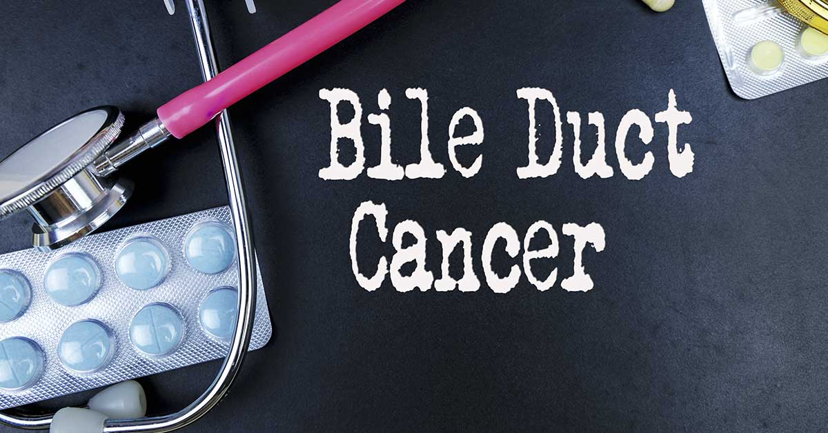 Bile duct cancer