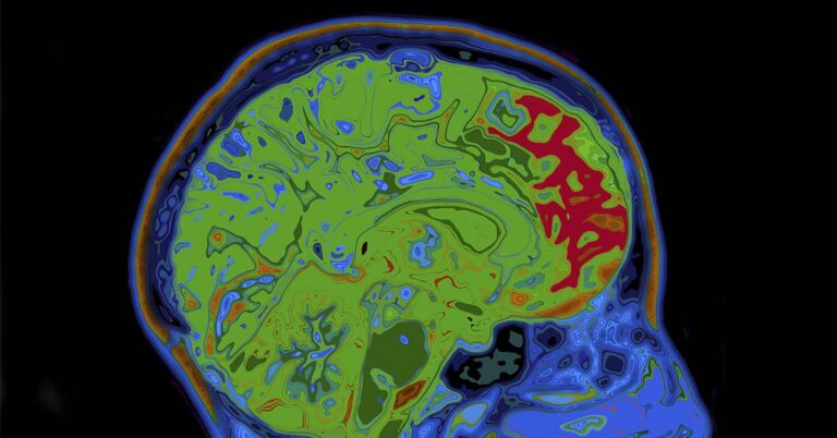 In World First, Teenage Boy is Cured of Lethal Brain Cancer - Featured image