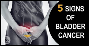 May28_Part01_Bladder