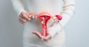 15 Signs Your Body Has Too Much Estrogen and What to Do About It Woman holding Uterus and Ovaries model. Ovarian and Cervical cancer, Cervix disorder, Endometriosis, Hysterectomy, Uterine fibroids, Reproductive system and Pregnancy concept