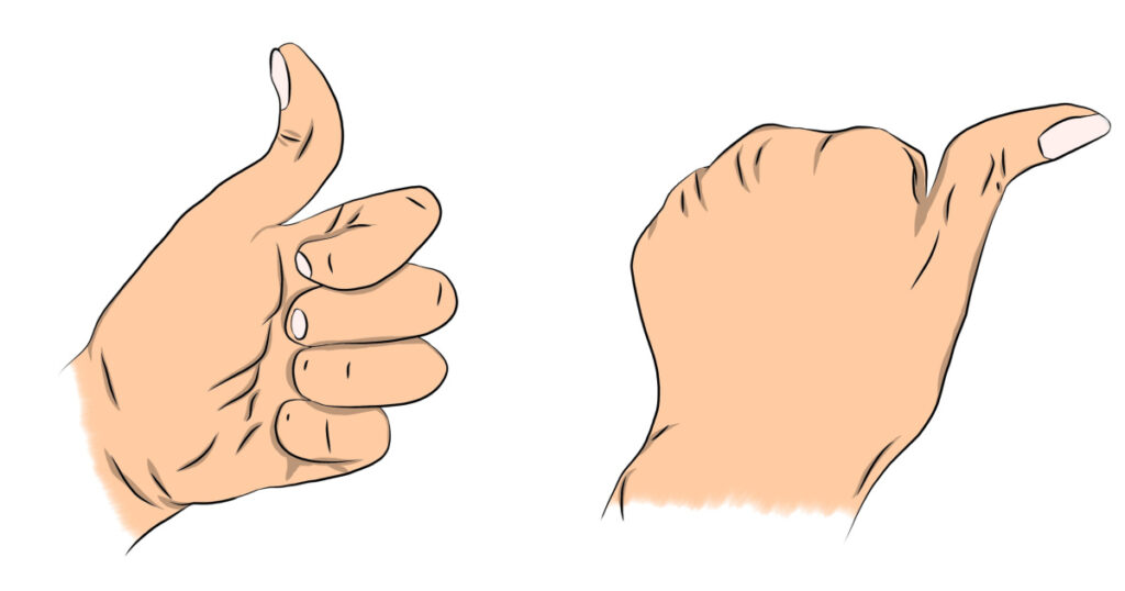 Illustration of left hand with hypermobility thumb. Finger flexibility with greater range of motion. Hypermobility articular joints. Orthopedics and rheumatology illustration. Isolated background.
