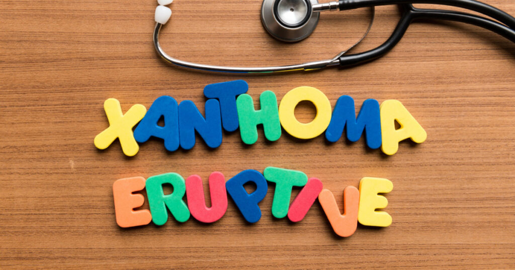 xanthoma eruptive colorful word with stethoscope on wooden background