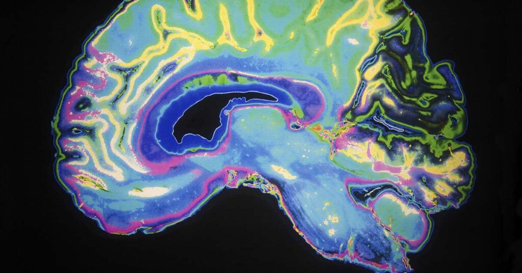 Wendy Mitchell, Famous Author and Dementia Campaigner Announces Own Death with Heartbreaking Open Letter - Featured image