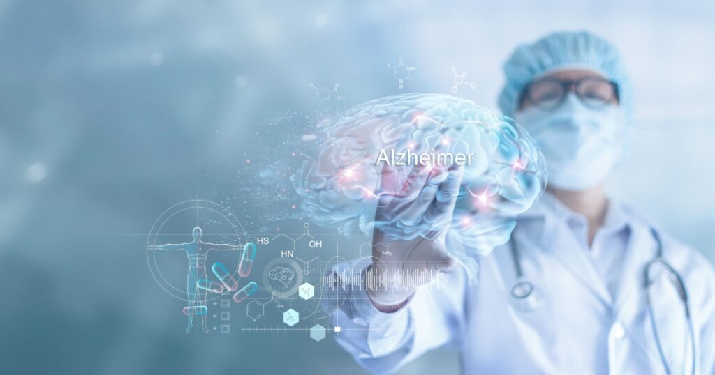 Abstract, Doctor checking and analysis alzheimer's disease and dementia of brain, testing result on virtual interface, innovative technology in science and medicine concept