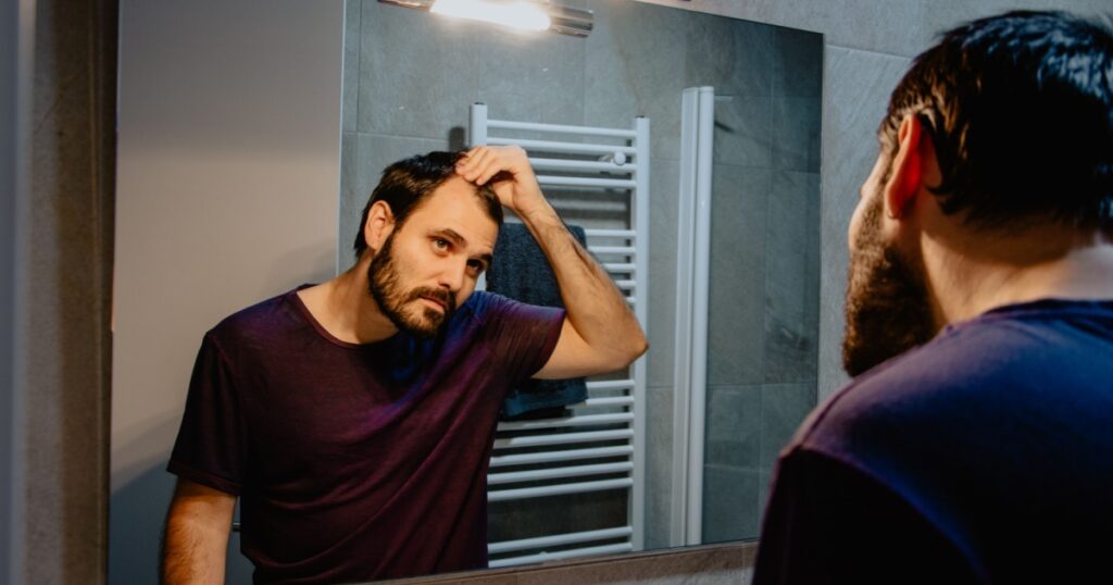 A worried young white man looks at himself in the mirror and inspects his premature receding hairline. Attractive Caucasian male adult in his 30s concerned about losing hair. Male pattern baldness
