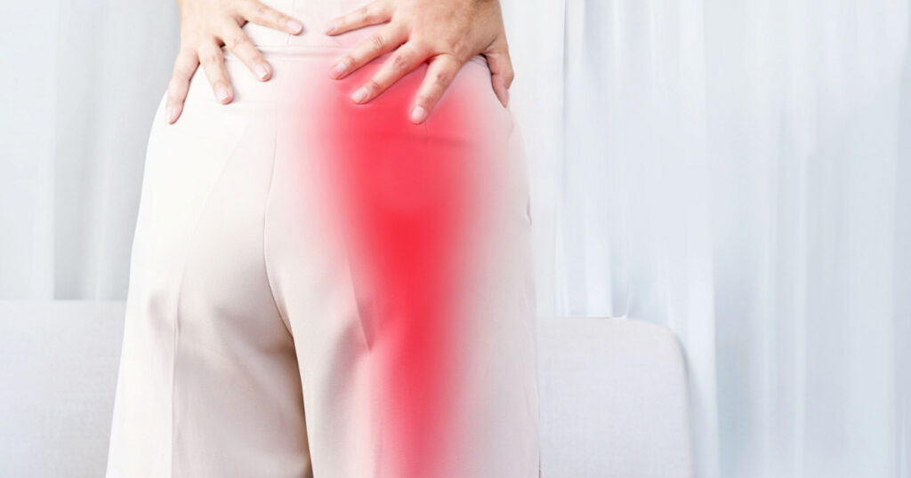 Sciatica Pain concept with woman suffering from buttock pain spreading to down leg