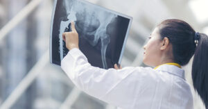 ‘Beloved’ College Dancer Diest at 20 of Bone Cancer doctor examining x-ray