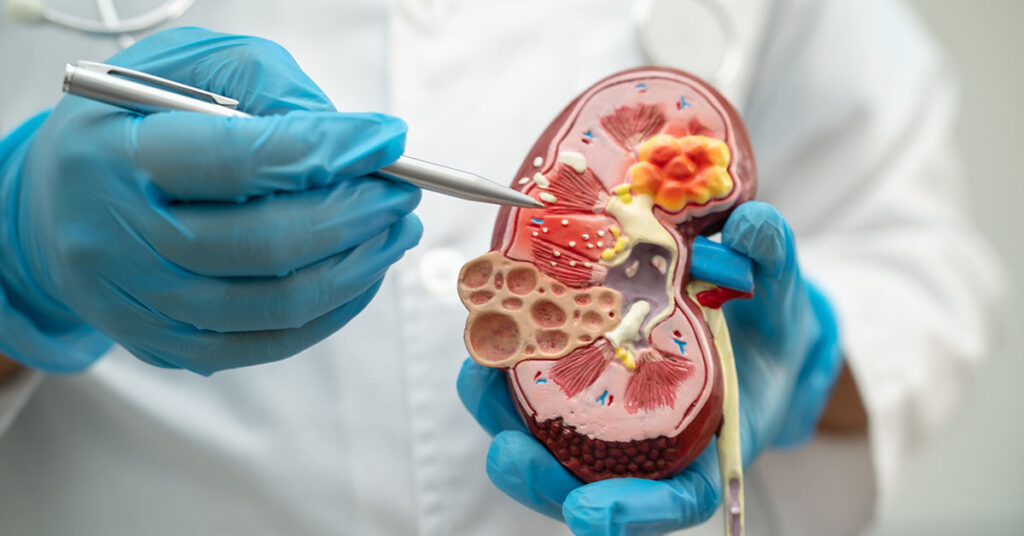 10 Warning Signs Your Kidneys Could Be Failing - Featured image