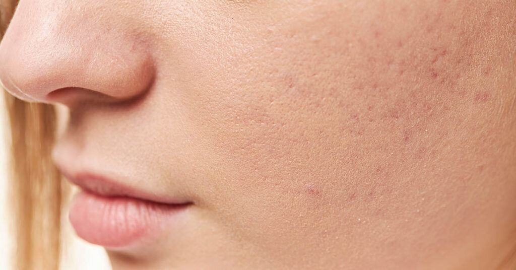 10 Medical Conditions Revealed Through Our Skin - Featured image