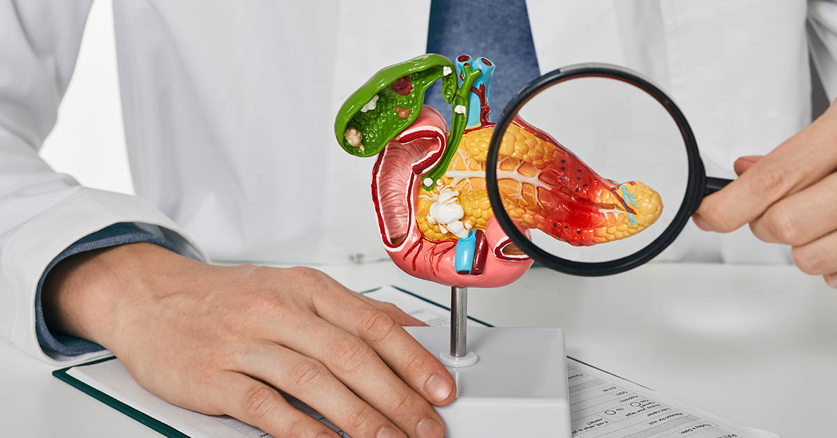 doctor with magnifying glass placed over model of pancreas. Pancreatic disease, pancreatic cancer concept