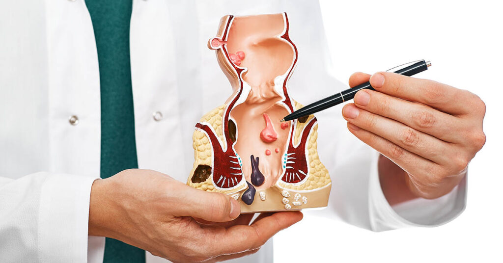 She Was Diagnosed With Stage 3 Cancer After Ignoring This ‘Embarrassing Symptom’ - Featured image