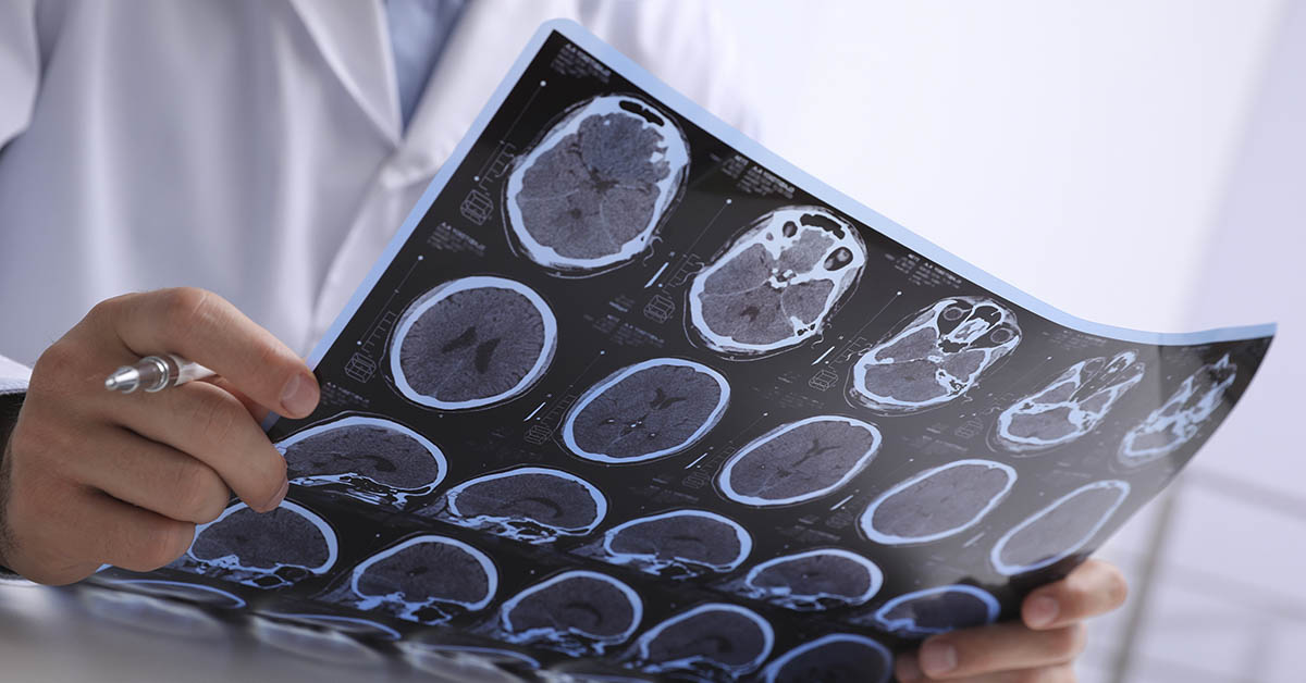 doctor looking at various brain scans of MRI results
