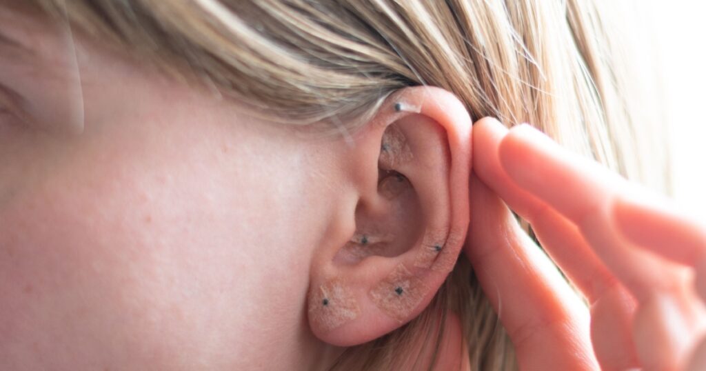 Woman shows acupuncture on the ear