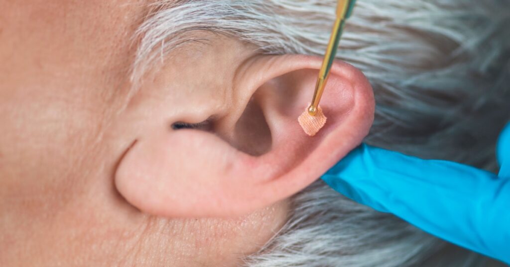 Auriculotherapy, or auricular treatment on human ear with flexible massage brass ear pen, close up. Acupuncture pressure on ear seed sticker.