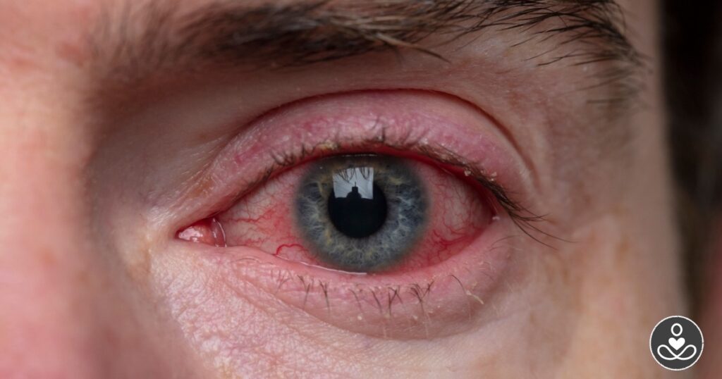 How to Help Prevent 8 Common Eye Issues - Featured image