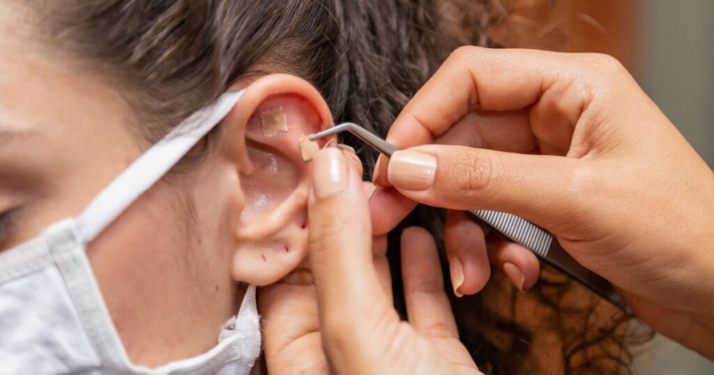 GOIANIA/GOIAS/BRAZIL - JUNE 08 2020: Holistic Therapy. Therapist applying auriculotherapy seeds to a patient's ear.